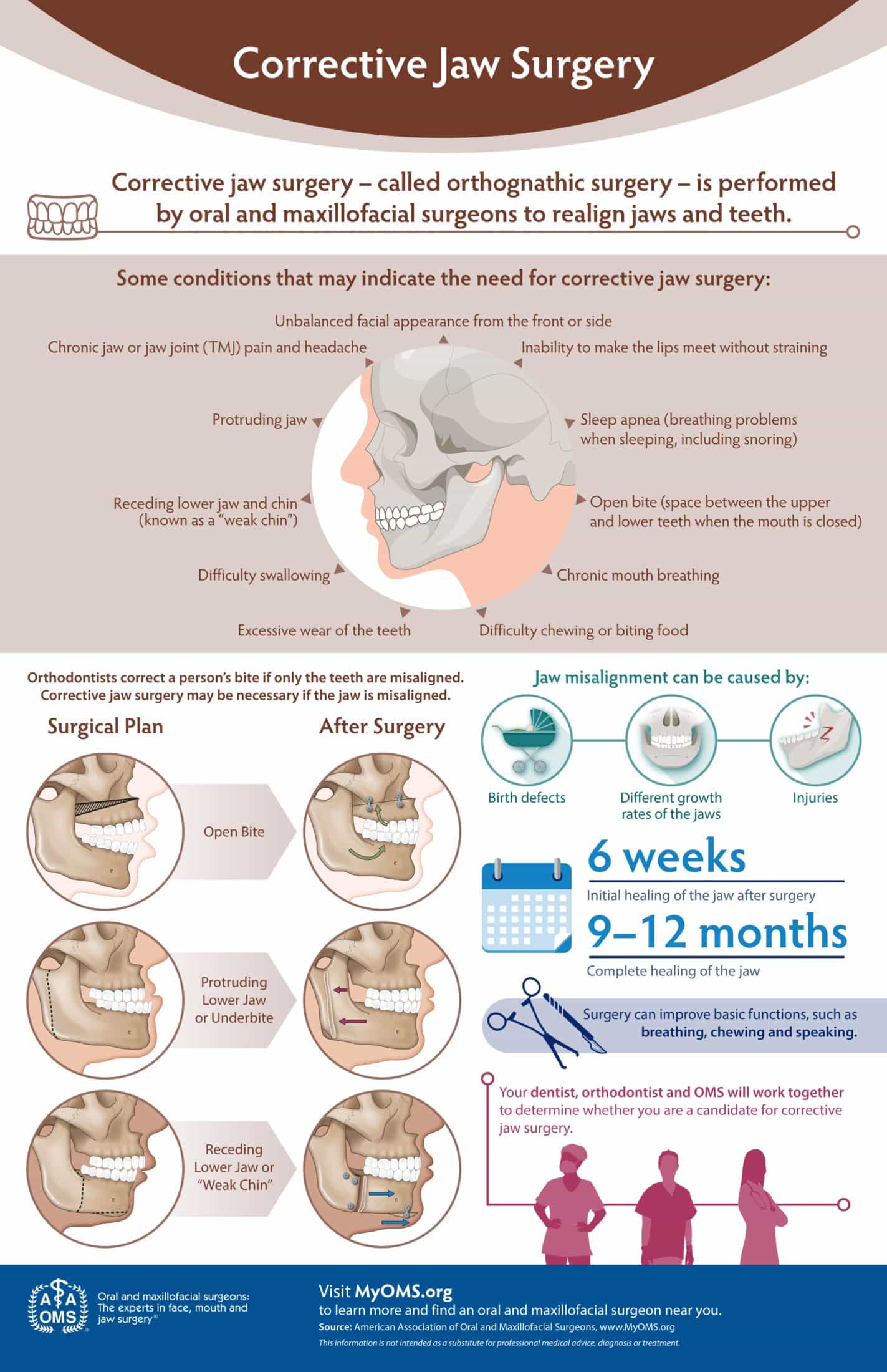 Corrective Jaw Surgery Infographic