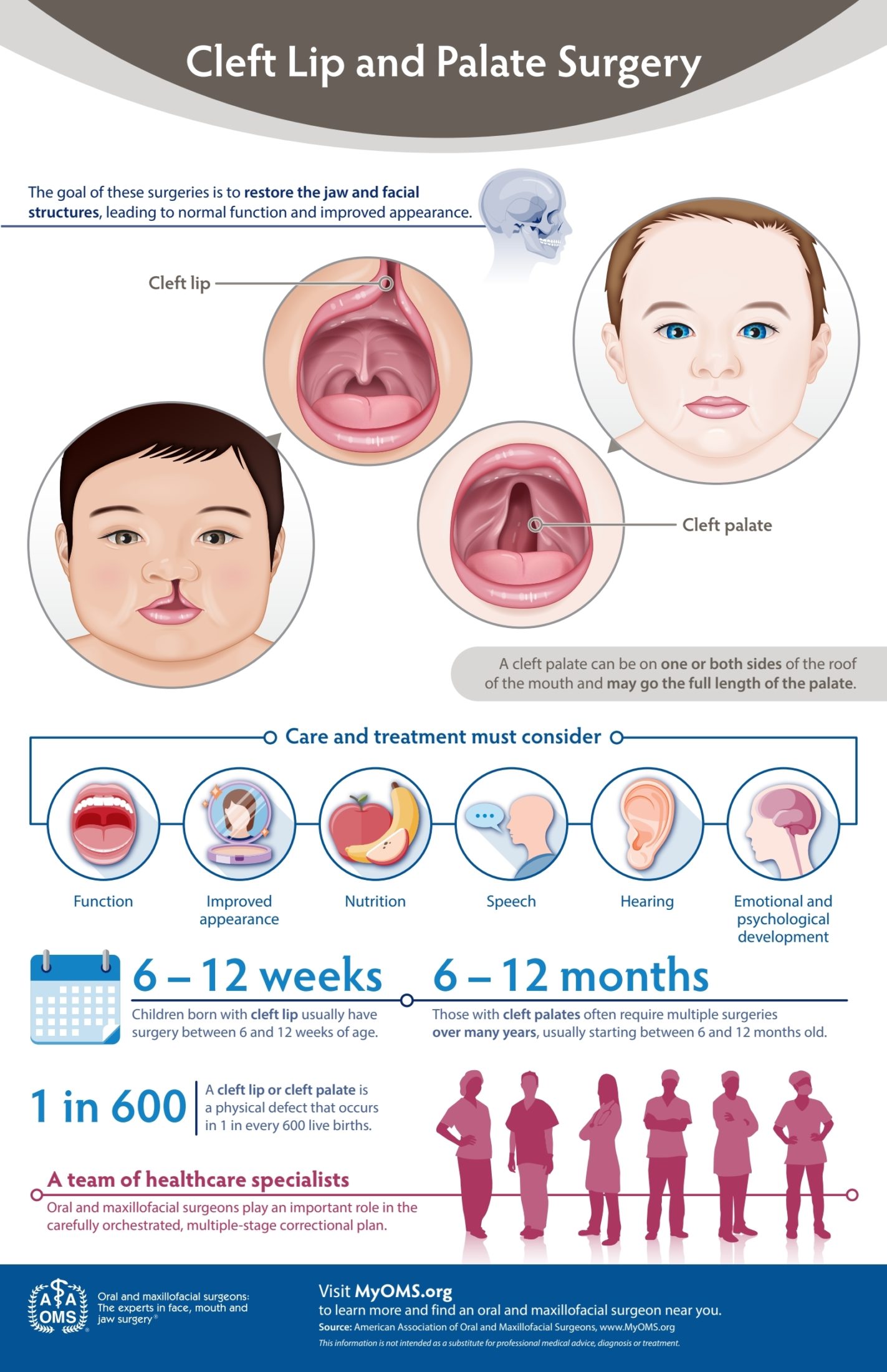 Cleft Lip and Palate Surgery Infographic
