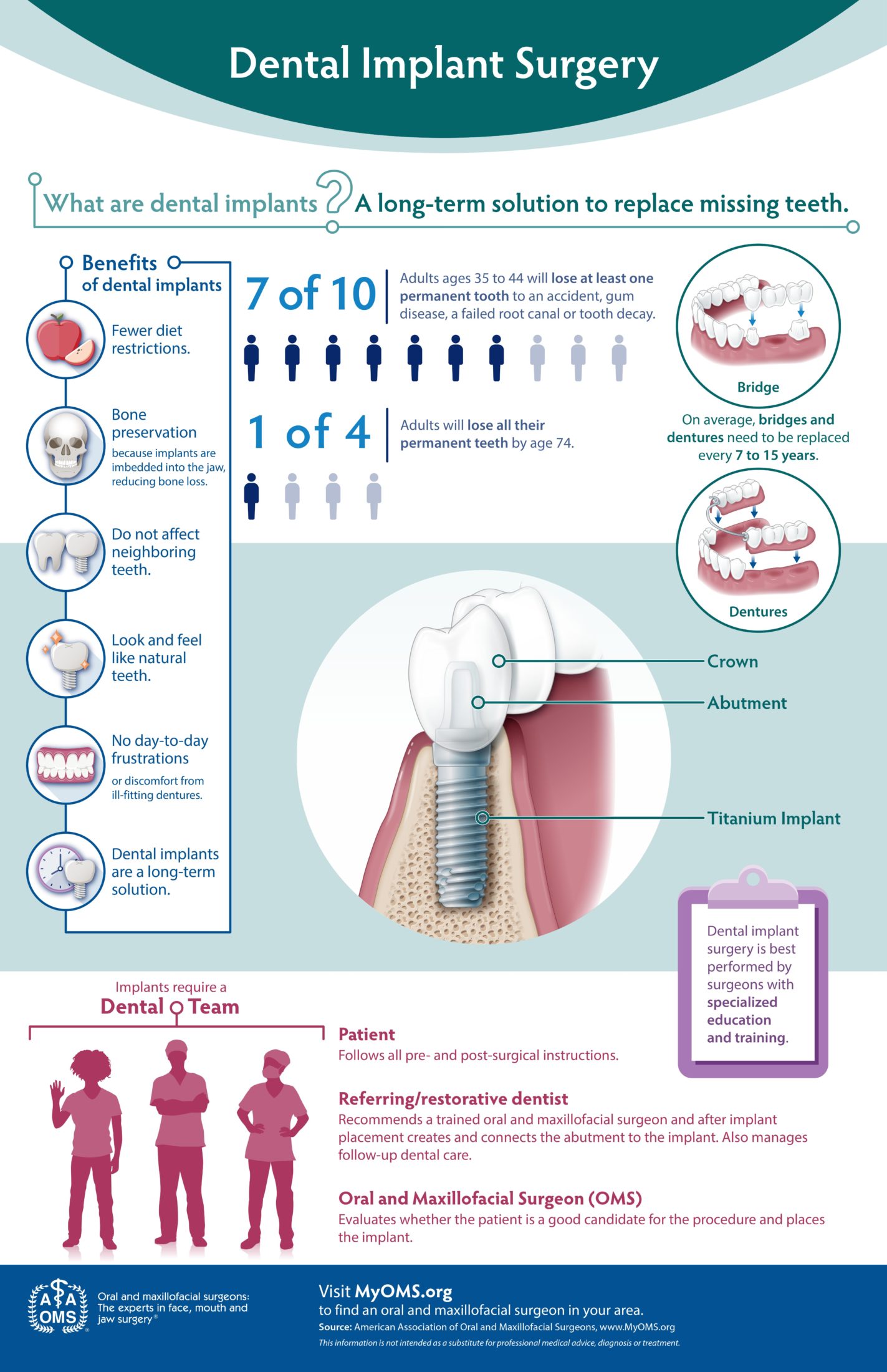 Dental Implant Surgery Infographic