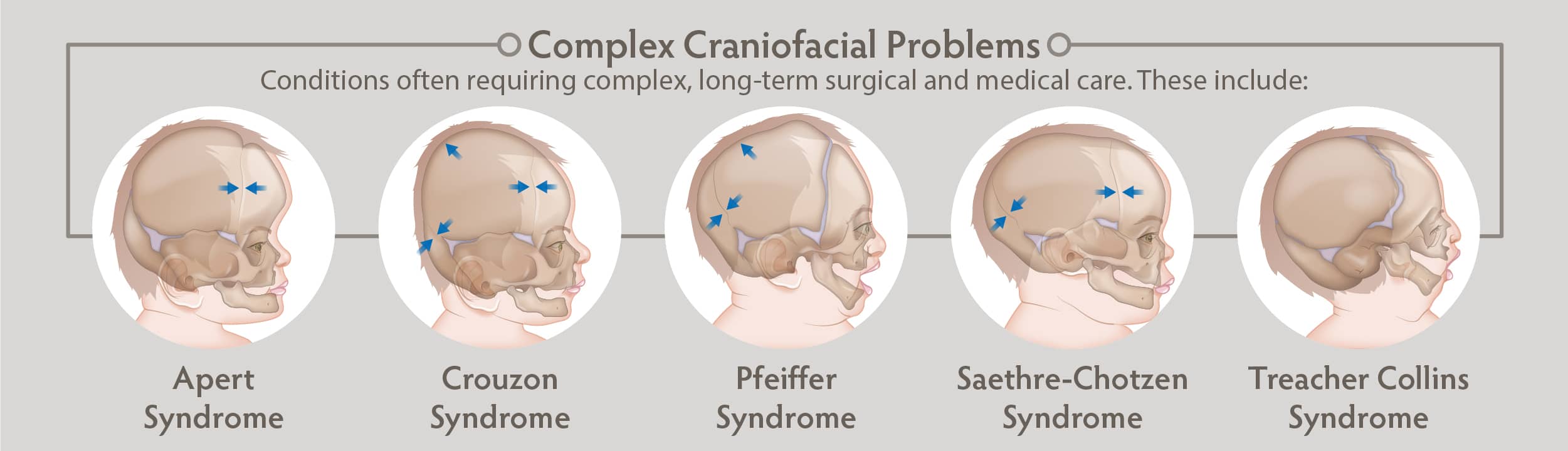complex craniofacial problems