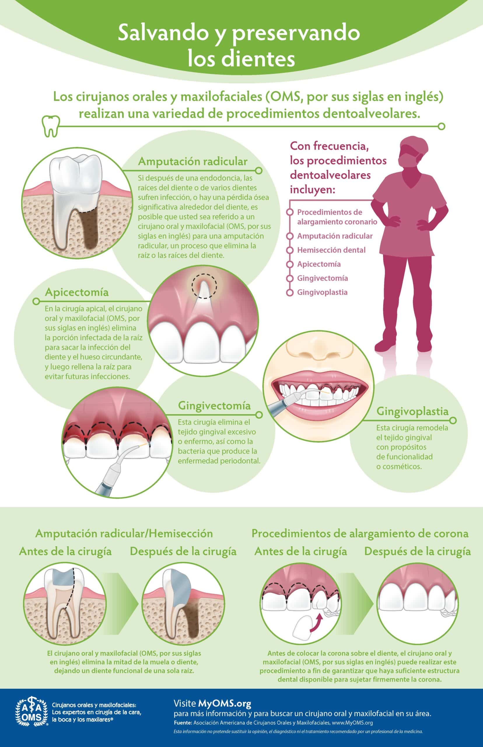 Saving and Preserving Teeth Infographic (Spanish)