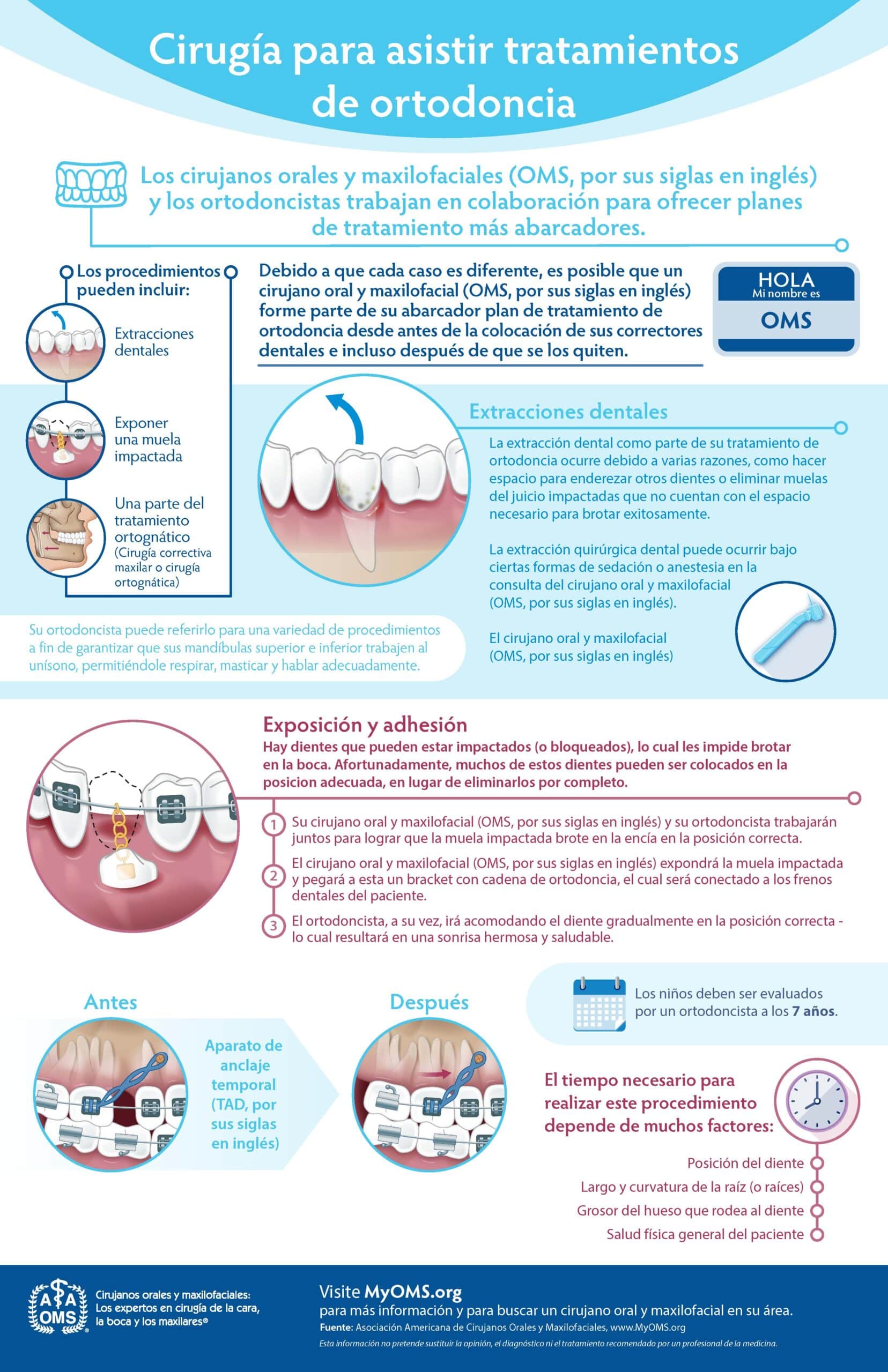 Surgery to Assist Orthodontics Infographic (Spanish)