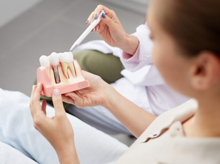 Explaining Tooth Implantation