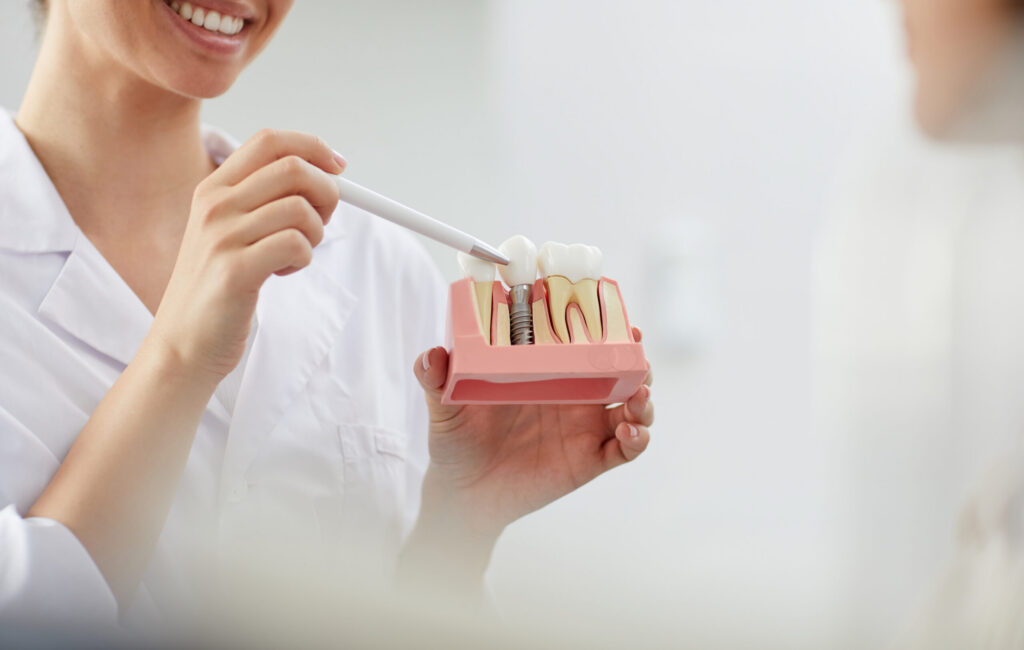 Smiling Dentist Explaining Tooth Implantation