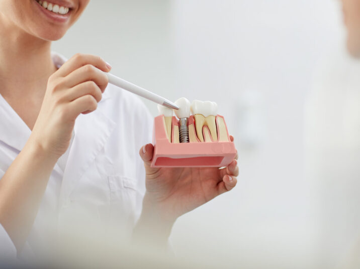 Smiling Dentist Explaining Tooth Implantation