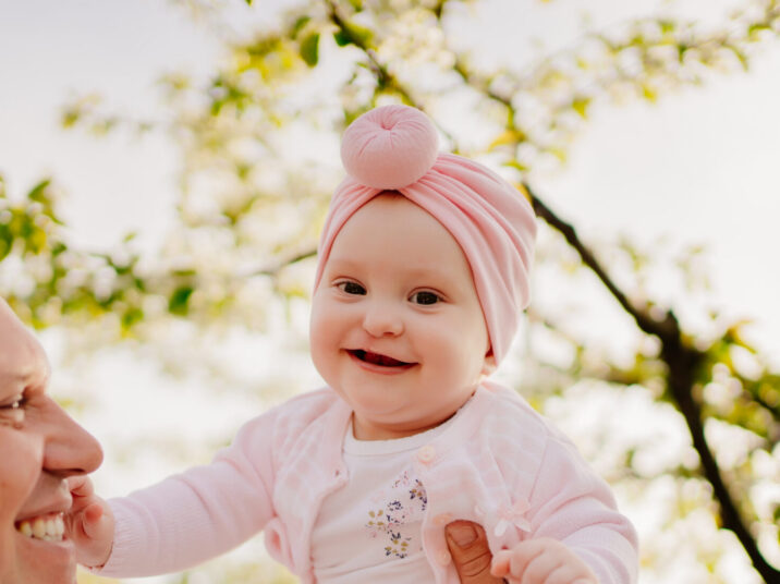 cleft lip
