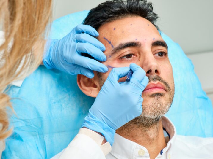 painting the face of a 45-year-old man for an aesthetic treatment with botulinum toxin