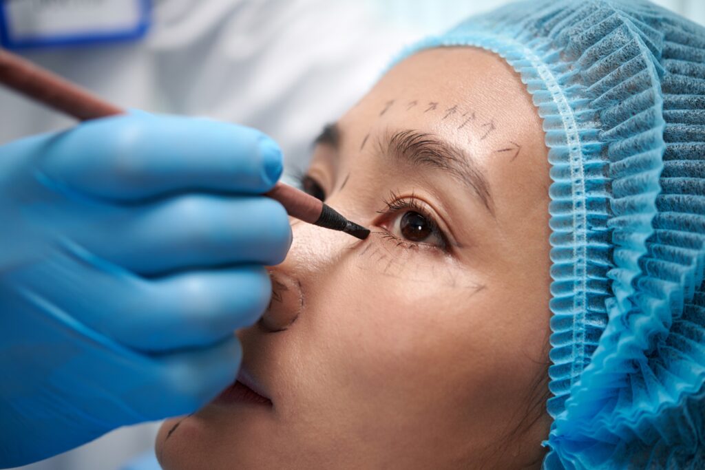 Woman Getting Blepharoplasty