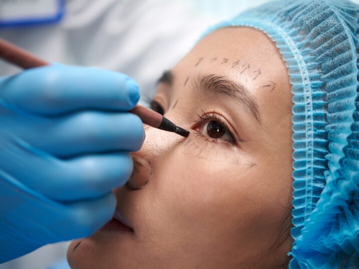 Woman Getting Blepharoplasty