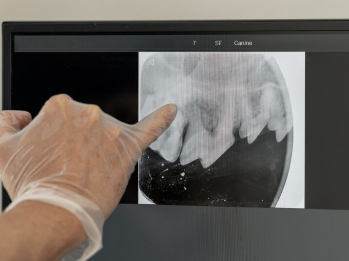 precision in dentistry: navigating tooth health with x-ray expertise