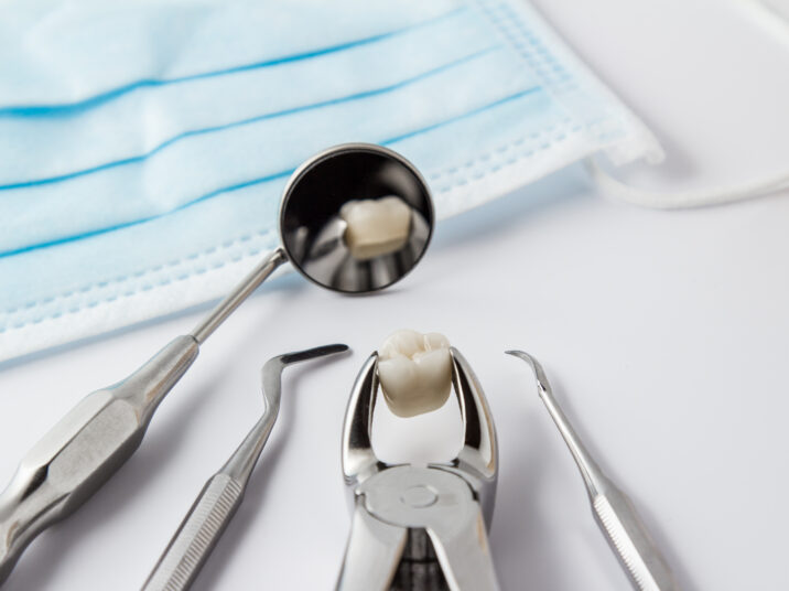 Tooth extraction concept
