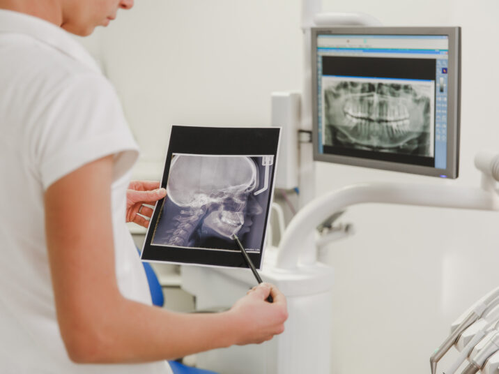 A female dentist holds an X-ray photo of a human skull from a profile on a computer background with a picture of the jaws in the dental office