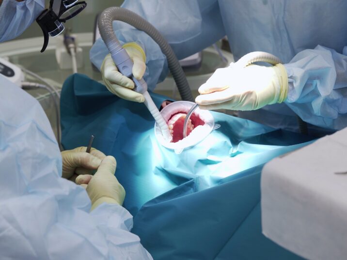 Professional,Doctors,Performing,Dental,Surgery,,Treating,Teeth,In,The,Patient's
