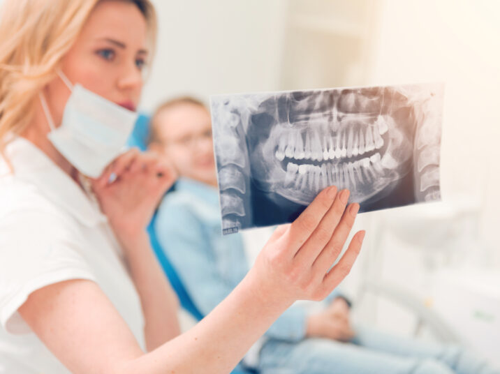 Close up of computed tomography scan held by dental professional