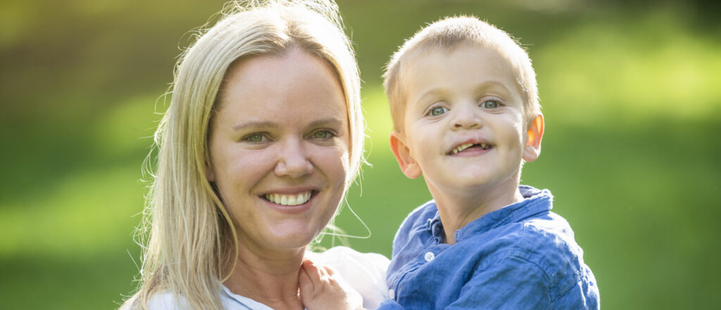 Cleft Lip and Cleft Palate