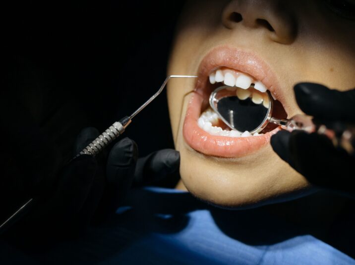 Childs mouth