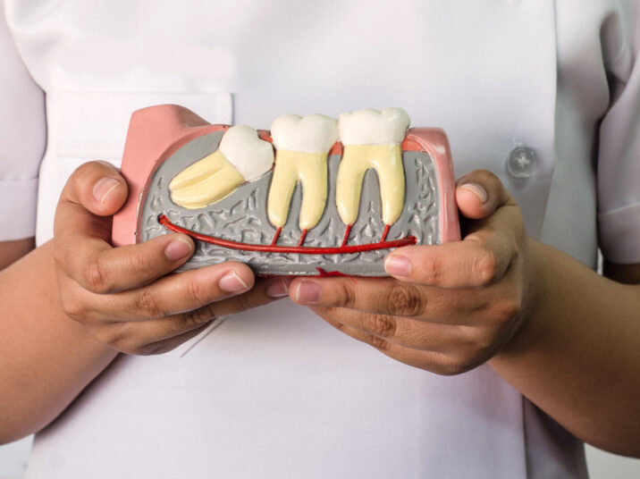 Dentist,Holding,A,Wisdom,Teeth,Model