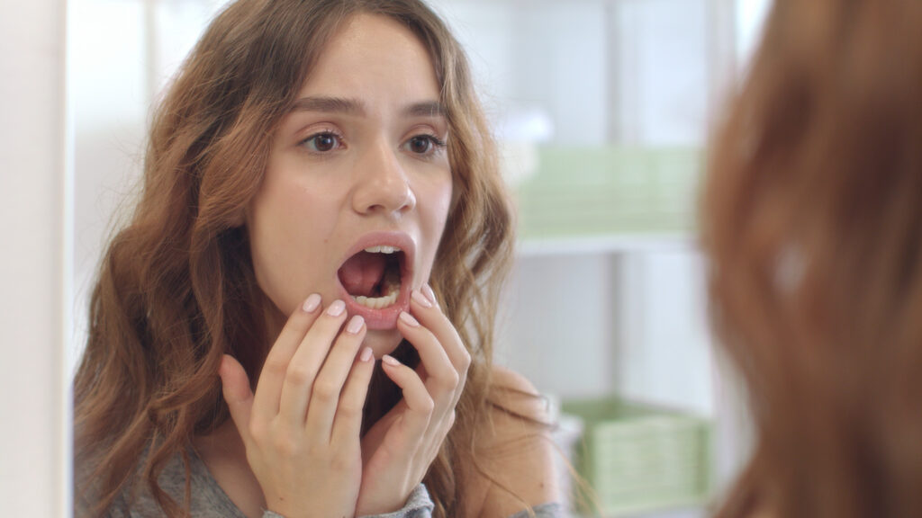 Young,Woman,With,Opened,Mouth,Checking,Teeth,In,Mirror,In